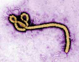 에볼라 확산 당국‘비상’  JFK 등 5개 공항서 검사